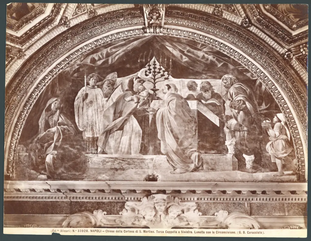 Circoncisione di Gesù