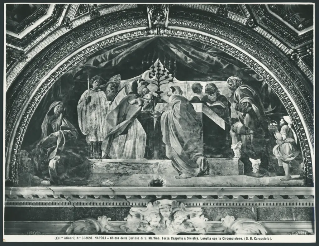 Circoncisione di Gesù